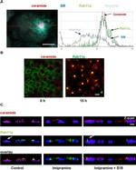RAB11A Antibody in Immunocytochemistry (ICC/IF)