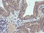 RAB21 Antibody in Immunohistochemistry (Paraffin) (IHC (P))