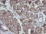 RAB21 Antibody in Immunohistochemistry (Paraffin) (IHC (P))