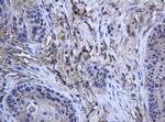 RAB21 Antibody in Immunohistochemistry (Paraffin) (IHC (P))