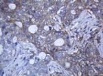 RAB21 Antibody in Immunohistochemistry (Paraffin) (IHC (P))