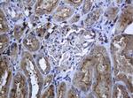 RAB21 Antibody in Immunohistochemistry (Paraffin) (IHC (P))