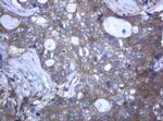 RAB21 Antibody in Immunohistochemistry (Paraffin) (IHC (P))