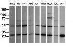 RAB21 Antibody in Western Blot (WB)
