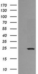 RAB21 Antibody in Western Blot (WB)