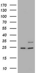 RAB21 Antibody in Western Blot (WB)