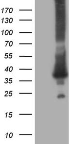 RAB23 Antibody in Western Blot (WB)