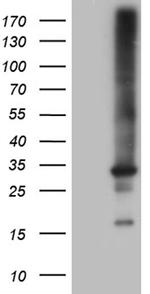 RAB23 Antibody in Western Blot (WB)