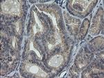 RAB30 Antibody in Immunohistochemistry (Paraffin) (IHC (P))