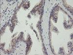 RAB30 Antibody in Immunohistochemistry (Paraffin) (IHC (P))