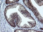 RAB37 Antibody in Immunohistochemistry (Paraffin) (IHC (P))