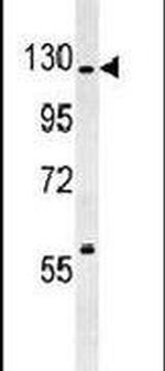 RABGAP1 Antibody in Western Blot (WB)