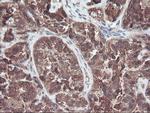 RABL2A Antibody in Immunohistochemistry (Paraffin) (IHC (P))