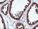 RABL2A Antibody in Immunohistochemistry (Paraffin) (IHC (P))