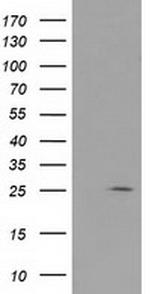 RABL2A Antibody in Western Blot (WB)
