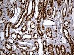 RAD21 Antibody in Immunohistochemistry (Paraffin) (IHC (P))