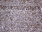 RAD21 Antibody in Immunohistochemistry (Paraffin) (IHC (P))