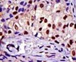 RAD23A Antibody in Immunohistochemistry (IHC)