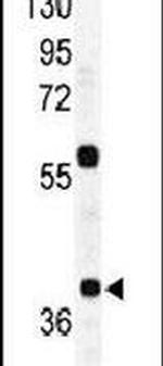 RAD23A Antibody in Western Blot (WB)