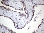 RAD23B Antibody in Immunohistochemistry (Paraffin) (IHC (P))
