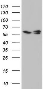 RAD23B Antibody in Western Blot (WB)