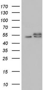 RAD23B Antibody in Western Blot (WB)