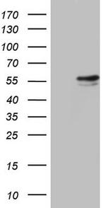 RAD23B Antibody in Western Blot (WB)