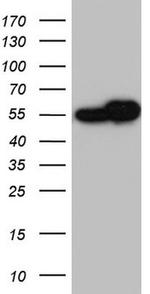 RAD23B Antibody in Western Blot (WB)