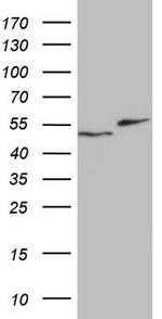 RAD23B Antibody in Western Blot (WB)