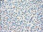 RAD9A Antibody in Immunohistochemistry (Paraffin) (IHC (P))