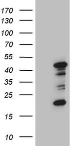 RAGE Antibody in Western Blot (WB)
