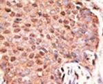 ZMIZ1 Antibody in Immunohistochemistry (IHC)