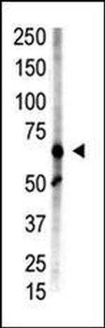 ZMIZ1 Antibody in Western Blot (WB)