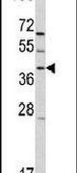 RAI3 Antibody in Western Blot (WB)