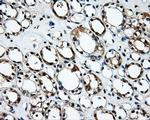 RALBP1 Antibody in Immunohistochemistry (Paraffin) (IHC (P))