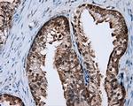 RALBP1 Antibody in Immunohistochemistry (Paraffin) (IHC (P))