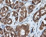 RALBP1 Antibody in Immunohistochemistry (Paraffin) (IHC (P))