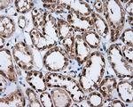RALBP1 Antibody in Immunohistochemistry (Paraffin) (IHC (P))