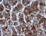 RALBP1 Antibody in Immunohistochemistry (Paraffin) (IHC (P))
