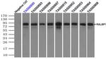RALBP1 Antibody in Immunoprecipitation (IP)