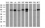 RALBP1 Antibody in Western Blot (WB)