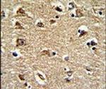 RAN Antibody in Immunohistochemistry (IHC)