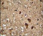 RAN Antibody in Immunohistochemistry (IHC)
