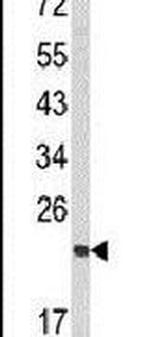 RAN Antibody in Western Blot (WB)