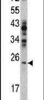 RAN Antibody in Western Blot (WB)