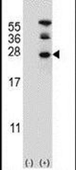 RAN Antibody in Western Blot (WB)