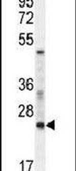 RAN Antibody in Western Blot (WB)