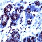RAN Antibody in Immunohistochemistry (IHC)