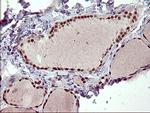 RAPGEF1 Antibody in Immunohistochemistry (Paraffin) (IHC (P))
