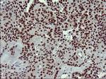 RAPGEF1 Antibody in Immunohistochemistry (Paraffin) (IHC (P))